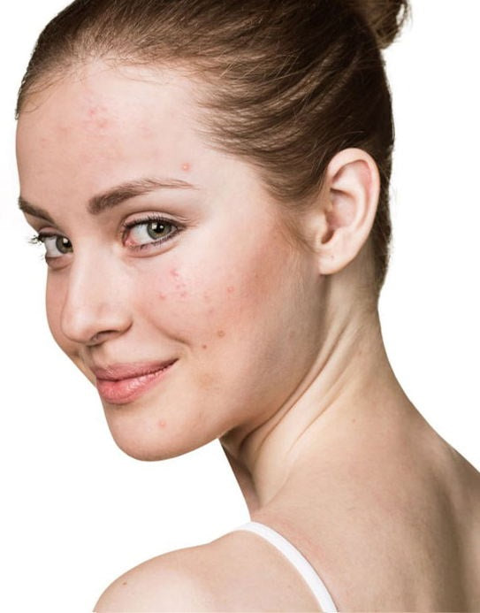 image comparison before