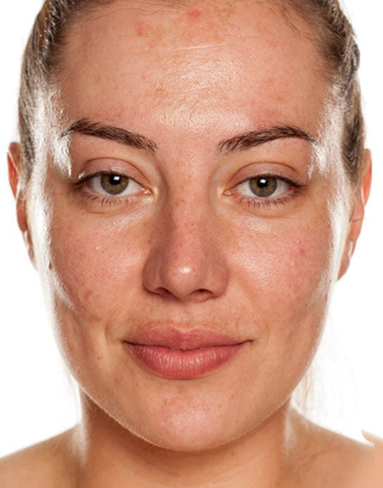 image comparison before