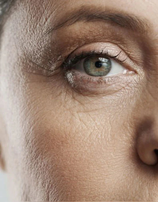 image comparison before